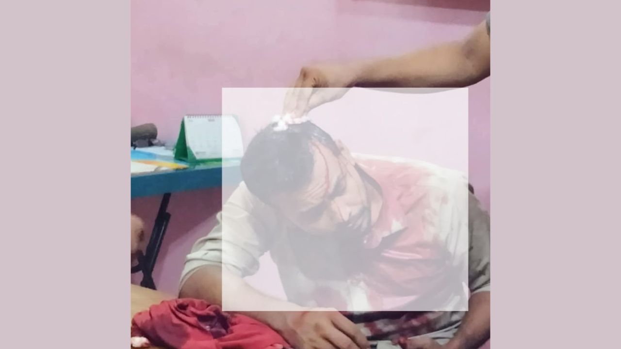 কাঁচপুরে ছিনতাইয়ের রাজত্ব, নীরব প্রশাসন