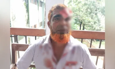 আদালত চত্বরে হত্যা মামলার সাক্ষীকে হাতুড়িপেটা