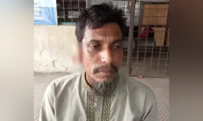 বাকিতে সিগারেট না পেয়ে দোকানির কান কামড়ে ছিঁড়ে দিলেন যুবক